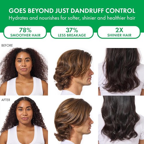 Dercos Dandruff Shampoo - Antifungal Treatment for Itchy Scalp Relief | Prescription Strength Selenium Sulfide