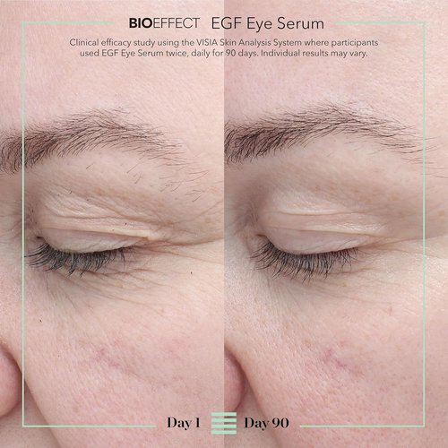 BIOEFFECT EGF Eye Serum - Age-Defying Rollerball Treatment for Fine Lines & Puffiness | 6 mL