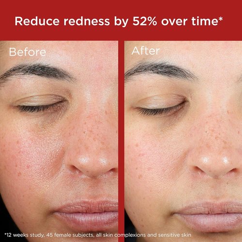 EltaMD UV Skin Recovery Sunscreen SPF 50 - All Mineral, Zinc Oxide Formula for Sensitive Skin