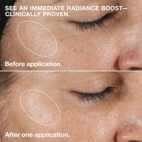 Clinique 3-Step Clarifying Lotion Face Exfoliator 2 | Toner With Witch Hazel | For Dry Combination Skin Types, 6.7 Fl Oz