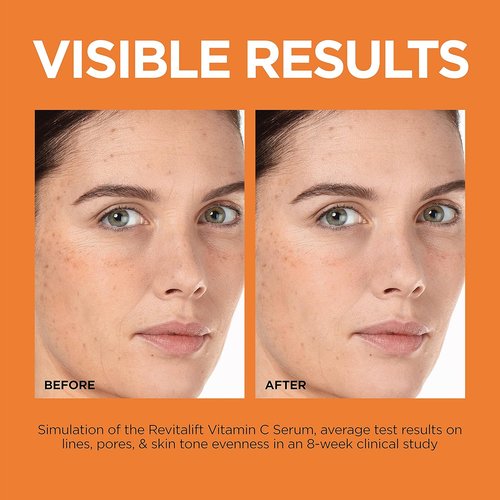 L'Oreal Paris Revitalift 12% Pure Vitamin C Serum - Brightening Face Serum with Vitamin E & Salicylic Acid, 1 oz