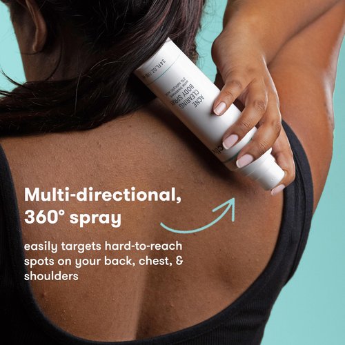 Proactiv Acne Clearing Salicylic Acid Body Spray, Multi-directional Mist for Back, Chest, Shoulders After Gym or Sweat, Formulated for Acne-prone Skin, 3.4 Fl Oz