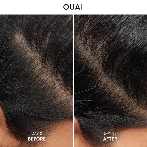 OUAI Anti Dandruff Shampoo - Soothing Salicylic Acid Formula for Flaky Scalp - Sulfate Free (10 Fl Oz)