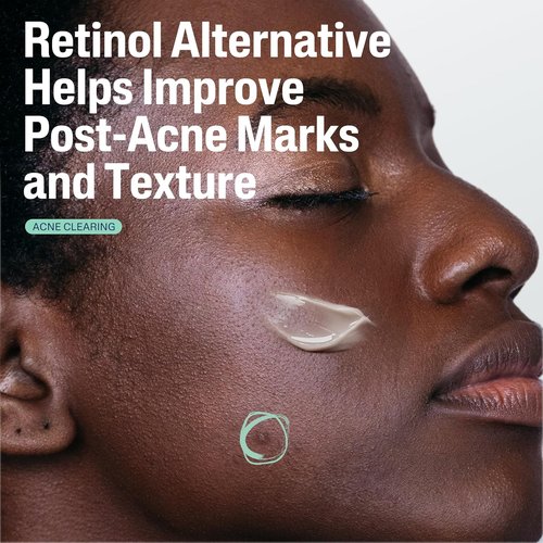 CETAPHIL Gentle Clear Post-Acne Serum - Oil-Free Retinol Alternative with Bakuchiol, 1 Fl Oz | Improves Skin Tone & Reduces Marks