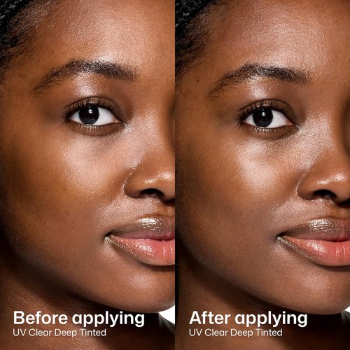 EltaMD UV Clear Face Sunscreen - Oil-Free Formula for Sensitive Skin with Zinc Oxide | Dermatologist Recommended
