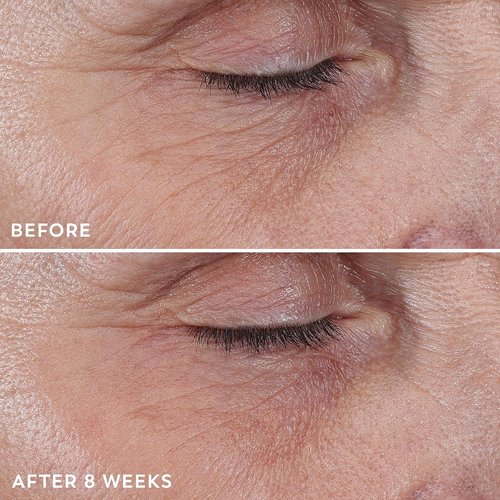Olay Regenerist Under Eye Cream Roller - Anti-Aging Eye Treatment for Wrinkles & Bags | 0.7oz