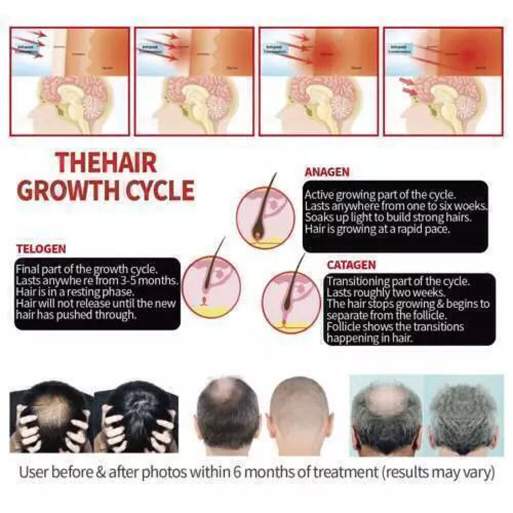 Red Light Therapy Hat for Hair Growth 650nm & 850nm Hair Loss Treatment Cap