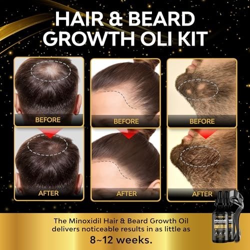 Minoxidil Beard & Hair Growth Kit 5% - Hair Regrowth Serum for Men & Women