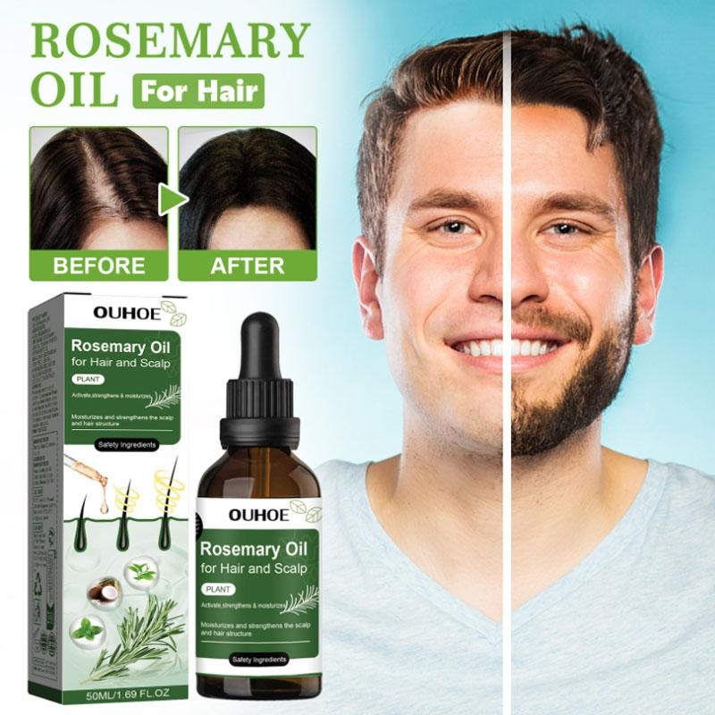 Hair Growth Oil for Hair Loss & Regrowth - Nourishing Rosemary Treatment 50ml