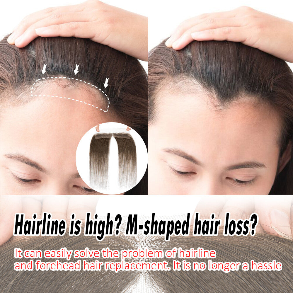 Full Lace Hair Topper for Women Receding Hairline Cover Remy Human Hair