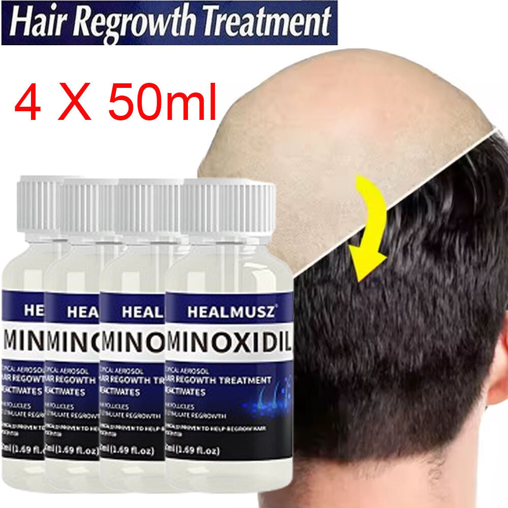 Men's Hair Regrowth Treatment with Minoxidil 5% - 4 Pack, 4 Month Supply
