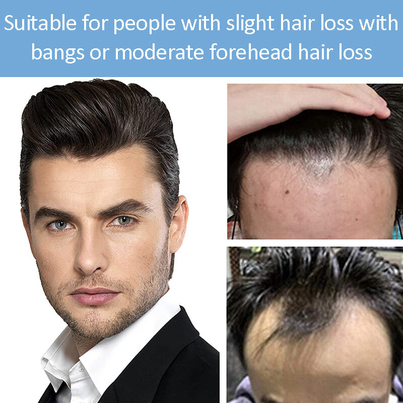 Mens Skin PU Front Hairpiece Toupee for Receding Hairline and Hair Loss