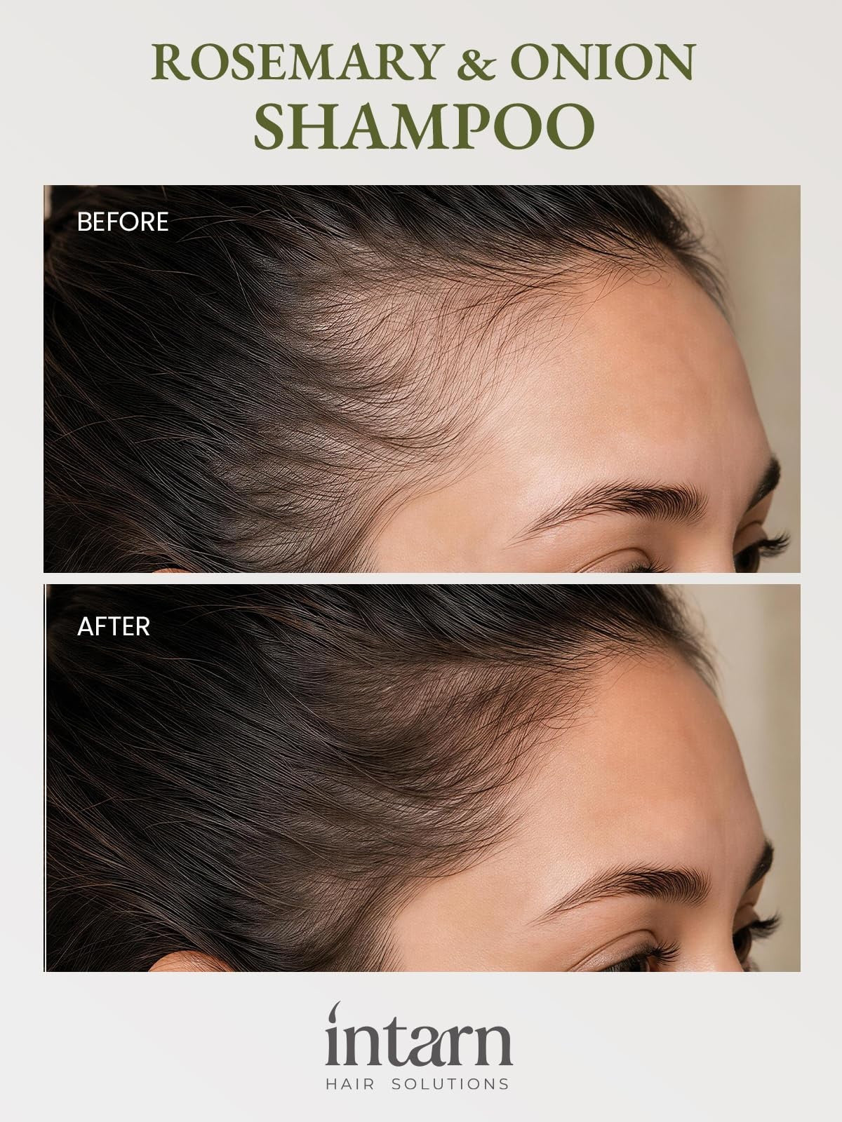 Hair Growth Shampoo for Thinning Hair with Rosemary & Onion - Nourishing 8 Fl Oz