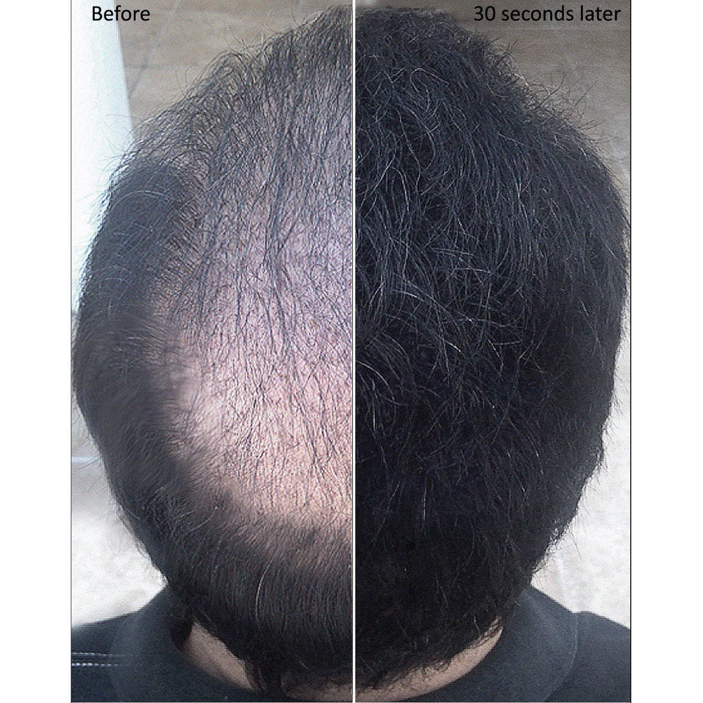 Hair Loss Concealer Fibers for Dark Blonde - 100g Refill, Natural Look