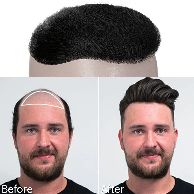Mens Skin PU Front Hairpiece Toupee for Receding Hairline and Hair Loss