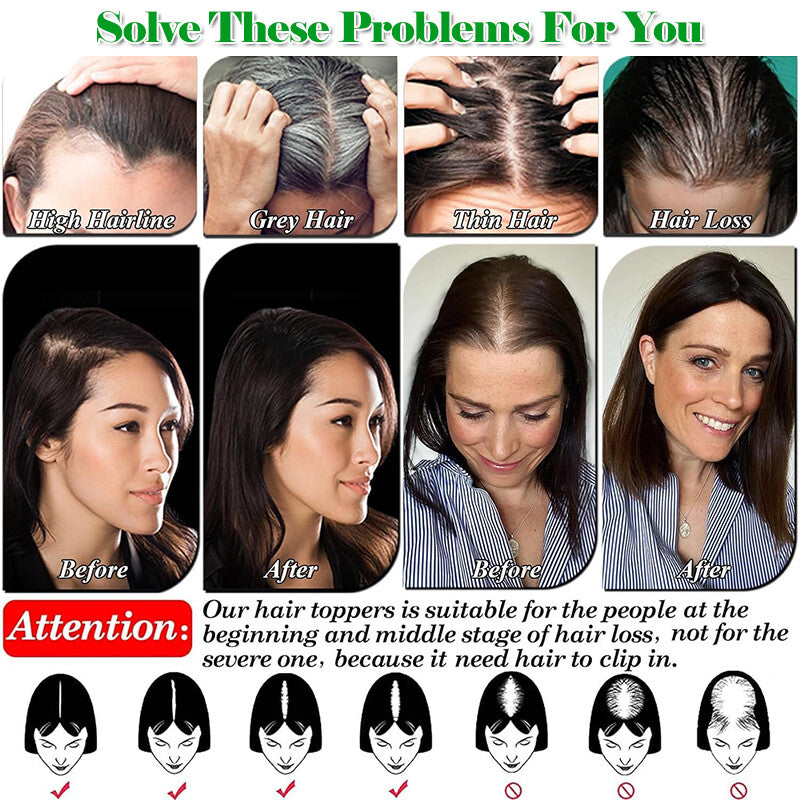 Clip-In Human Hair Topper with Lace Base - Remy Hair for Thinning Hair