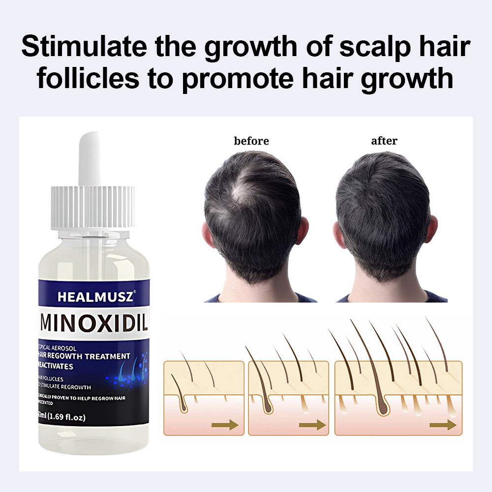 Men's Hair Regrowth Treatment with Minoxidil 5% - 4 Pack, 4 Month Supply