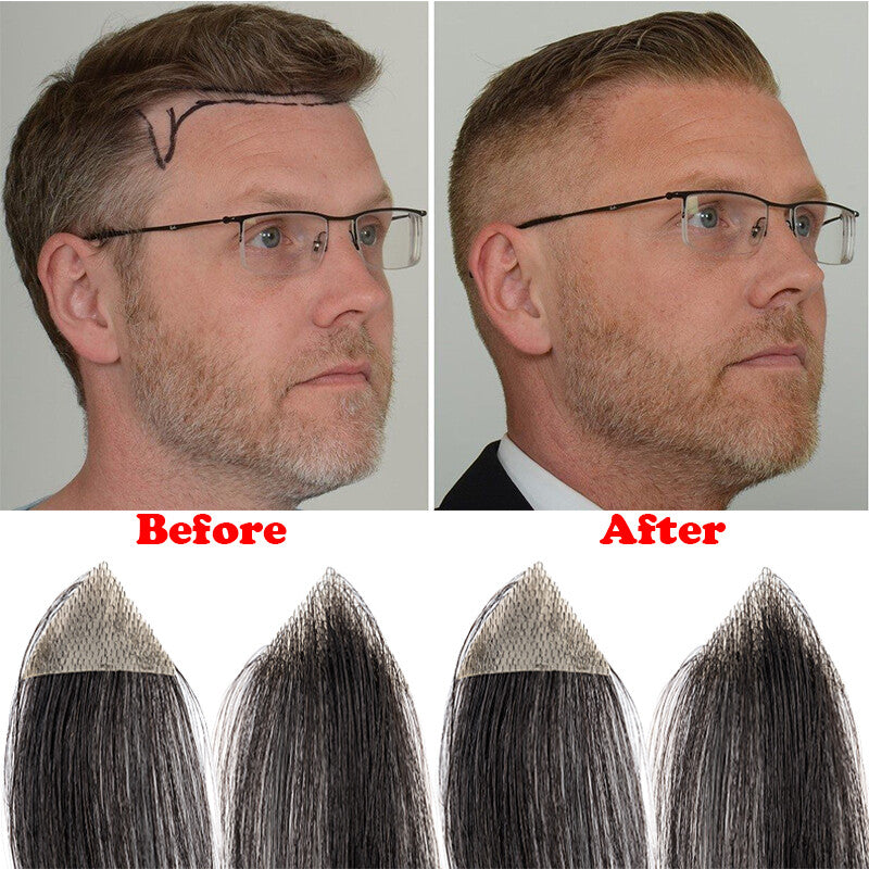 100% Remy Human Hair Mini Hairpieces for Men Temple Hairline Replacement