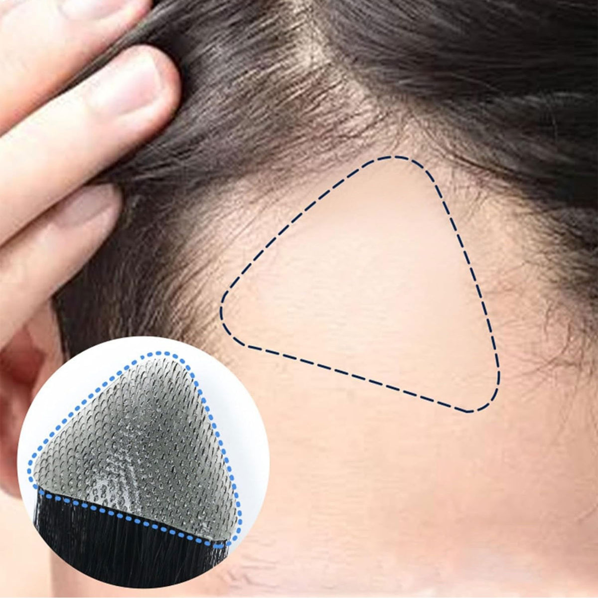 Remy Human Hair Topper Pieces for Bald Spots - Natural Look & Easy to Use