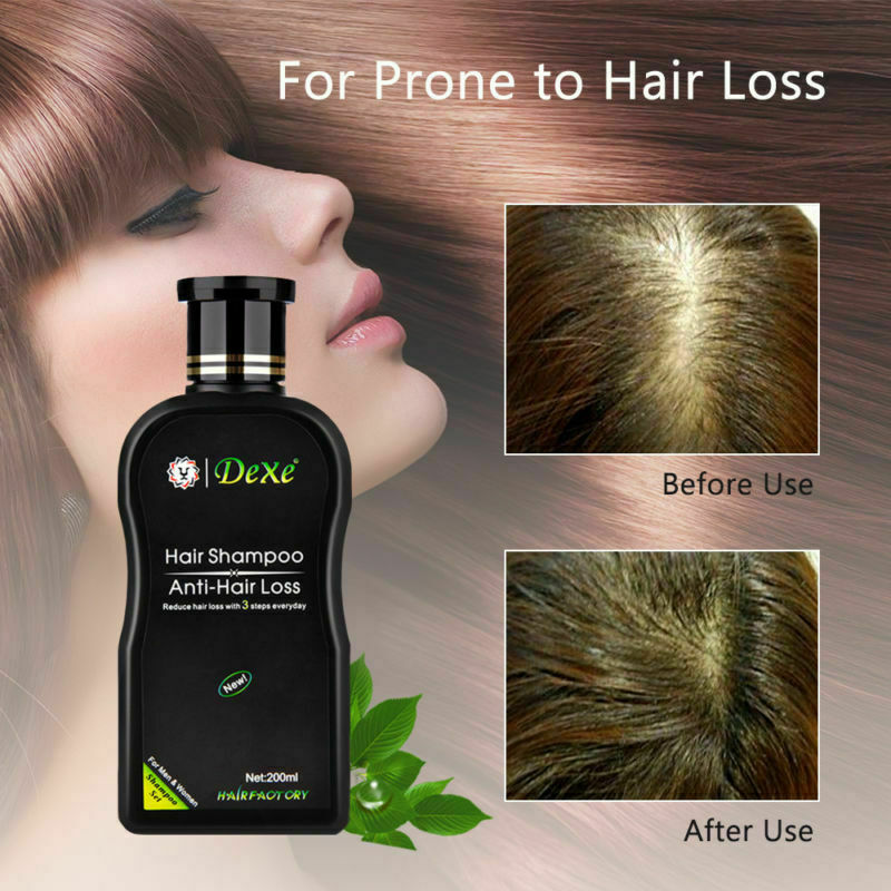 Anti-Hair Loss Shampoo for Men & Women - Herbal Hair Regrowth 200ml