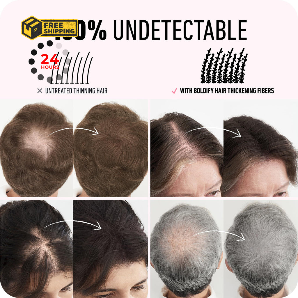 Hair Fibers for Thinning Hair - Fill In Volume & Conceal Bald Spots, 12g Ash Brown