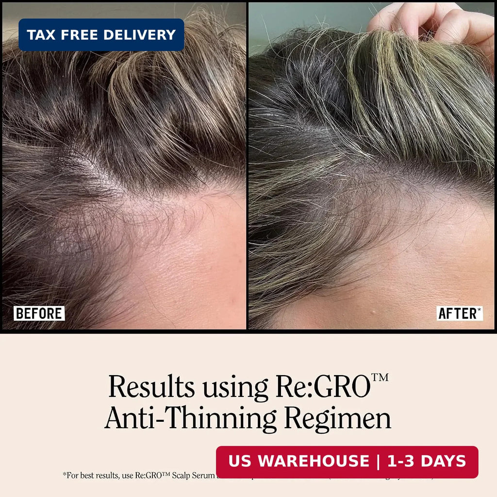 Men's Hair Growth Serum with Capixyl & Biotin - Thicker, Fuller Hair Support
