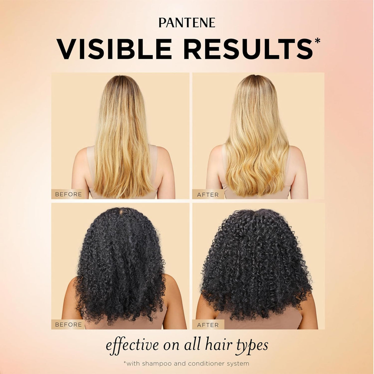 Pantene Pro-V Miracles Anti-Hair Loss Shampoo 13.5oz Daily Strengthening