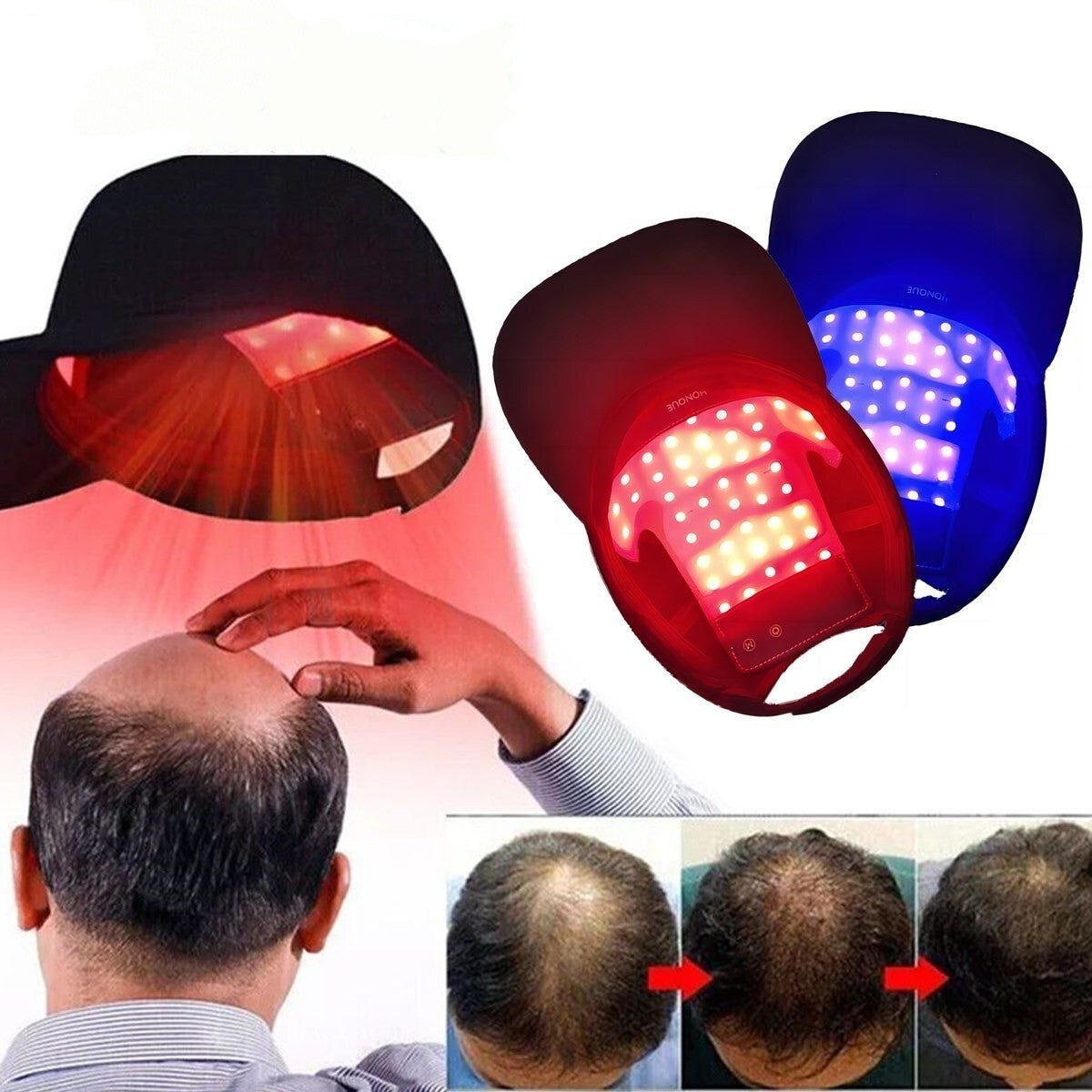 Red LED Light Therapy Hat for Hair Loss & Regrowth - 650nm 630nm 470nm