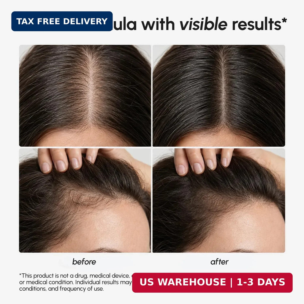Hair Growth Serum with Caffeine Peptides Castor Rosemary Oil for Women & Men
