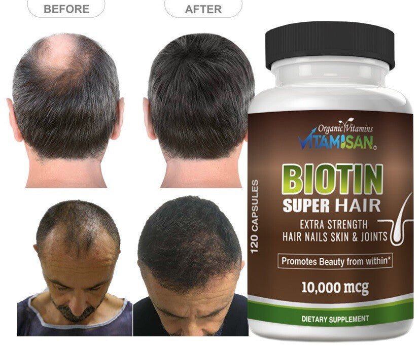 Hair Growth Vitamins - Biotin Support for Hair Loss - 240 Capsules