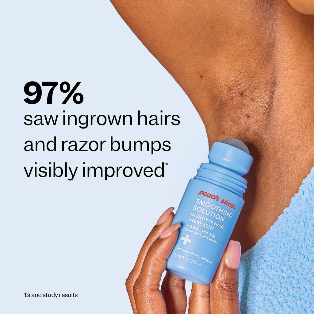 Ingrown Hair Treatment Roller - Smoothing Solution for Razor Bumps & Dark Spots 1.69 oz