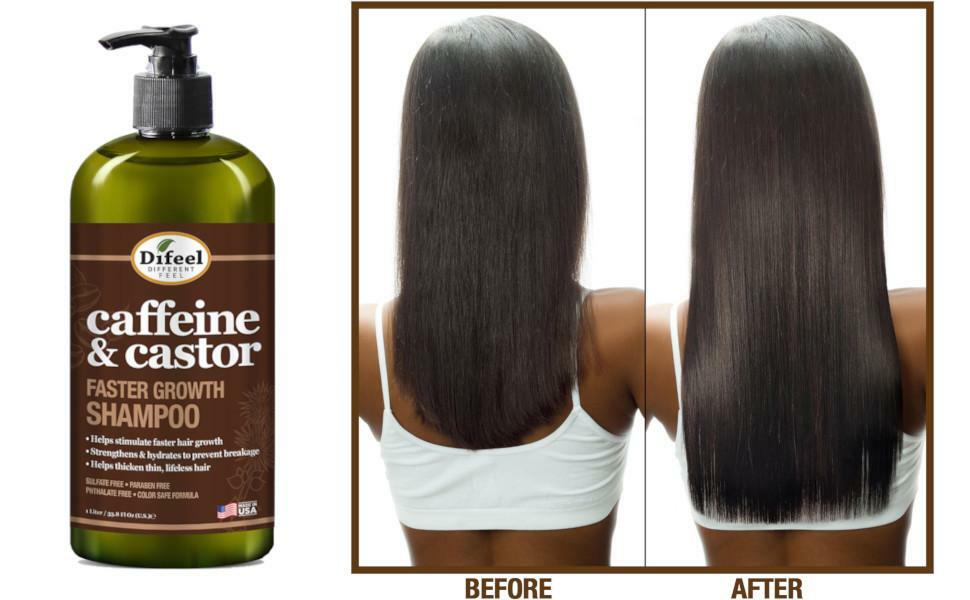 Caffeine & Castor Hair Growth Shampoo 33.8 oz - Strengthening & Hydrating