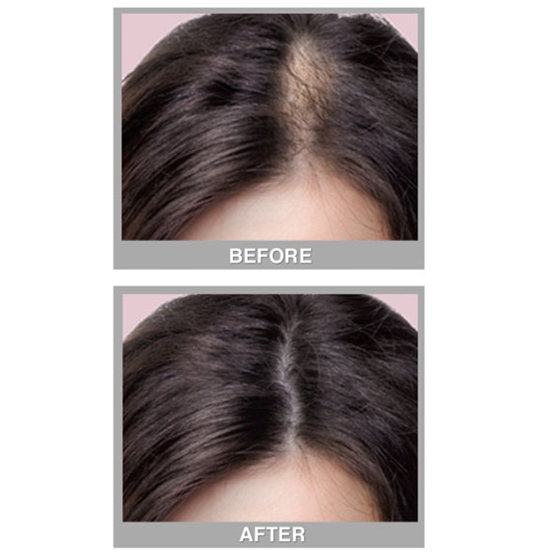 3-Pack Hair Concealer Powder for Thinning & Bald Spots - 8 Shades