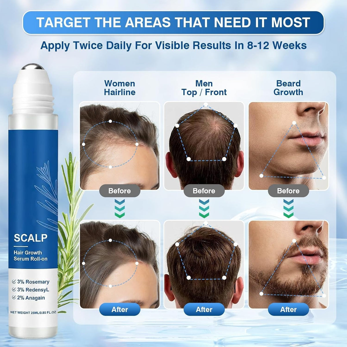 Hair Growth Serum Roll-On for Thinning Hair - 2 Pack, Lightweight & Non-Greasy