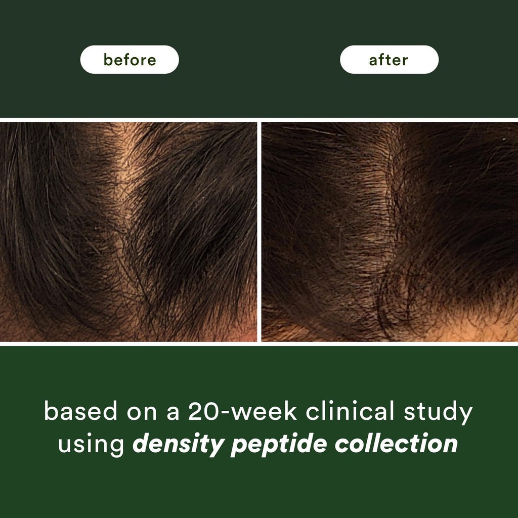 Density Peptide Shampoo for Thicker Hair & Reduced Shedding - 12 fl oz