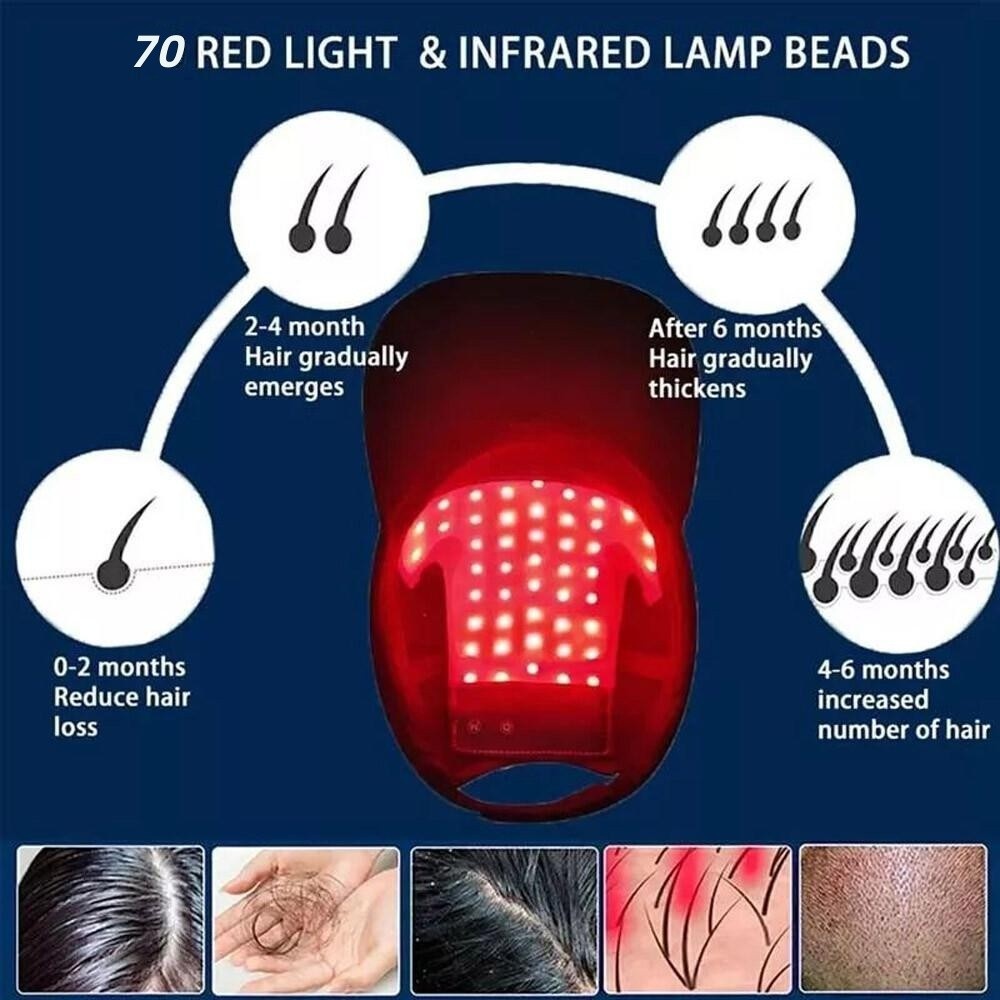 Red LED Light Therapy Hat for Hair Loss & Regrowth - 650nm 630nm 470nm