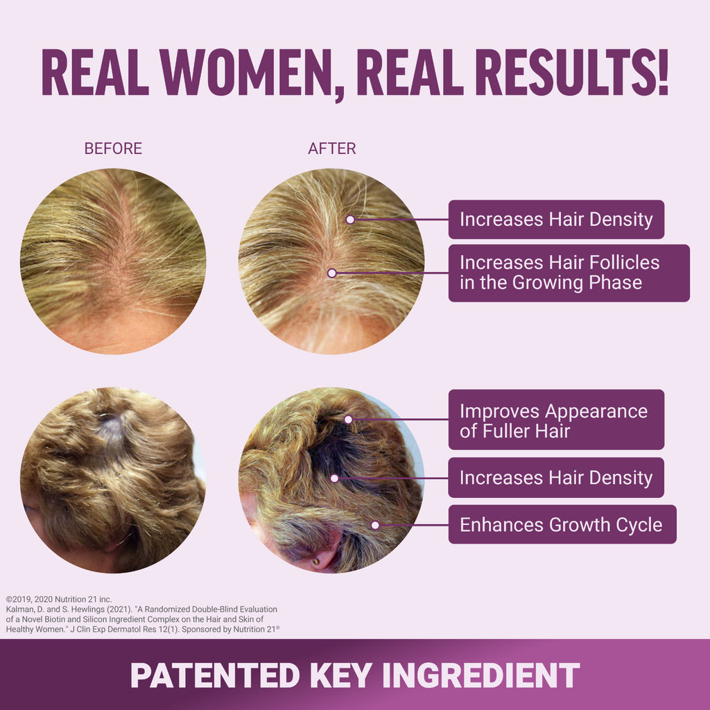 Hair Growth Vitamins with Biotin & Silicon - Soft Chews for Women