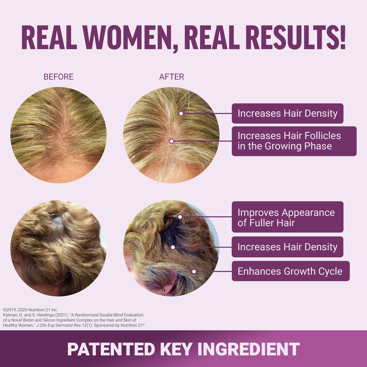 Hair Growth Vitamins with Biotin & Silicon - Soft Chews for Women
