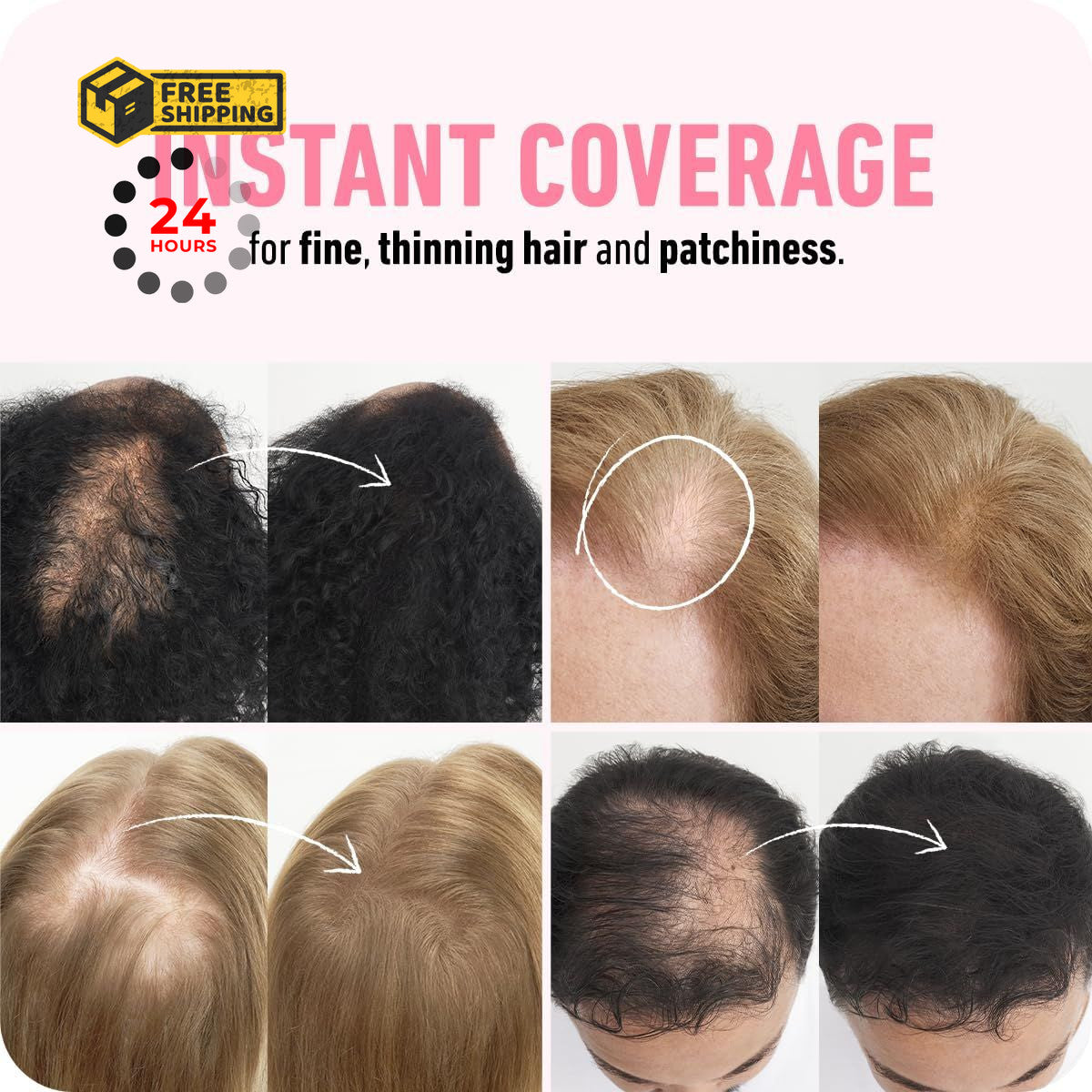 Hair Fibers for Thinning Hair - Fill In Volume & Conceal Bald Spots, 12g Ash Brown