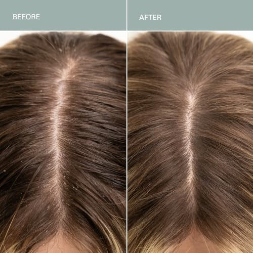 Detox Clarifying Shampoo & Salt Scalp Scrub - Sulfate-Free Deep Cleanse for All Hair Types