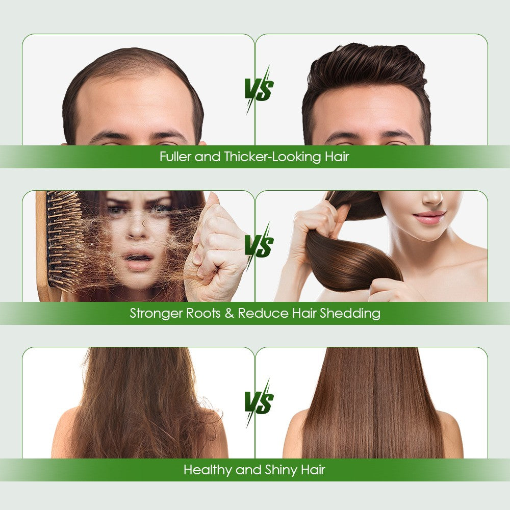 Microneedle Infusion Hair Regrowth System for Thicker Hair - Multiple Quantities