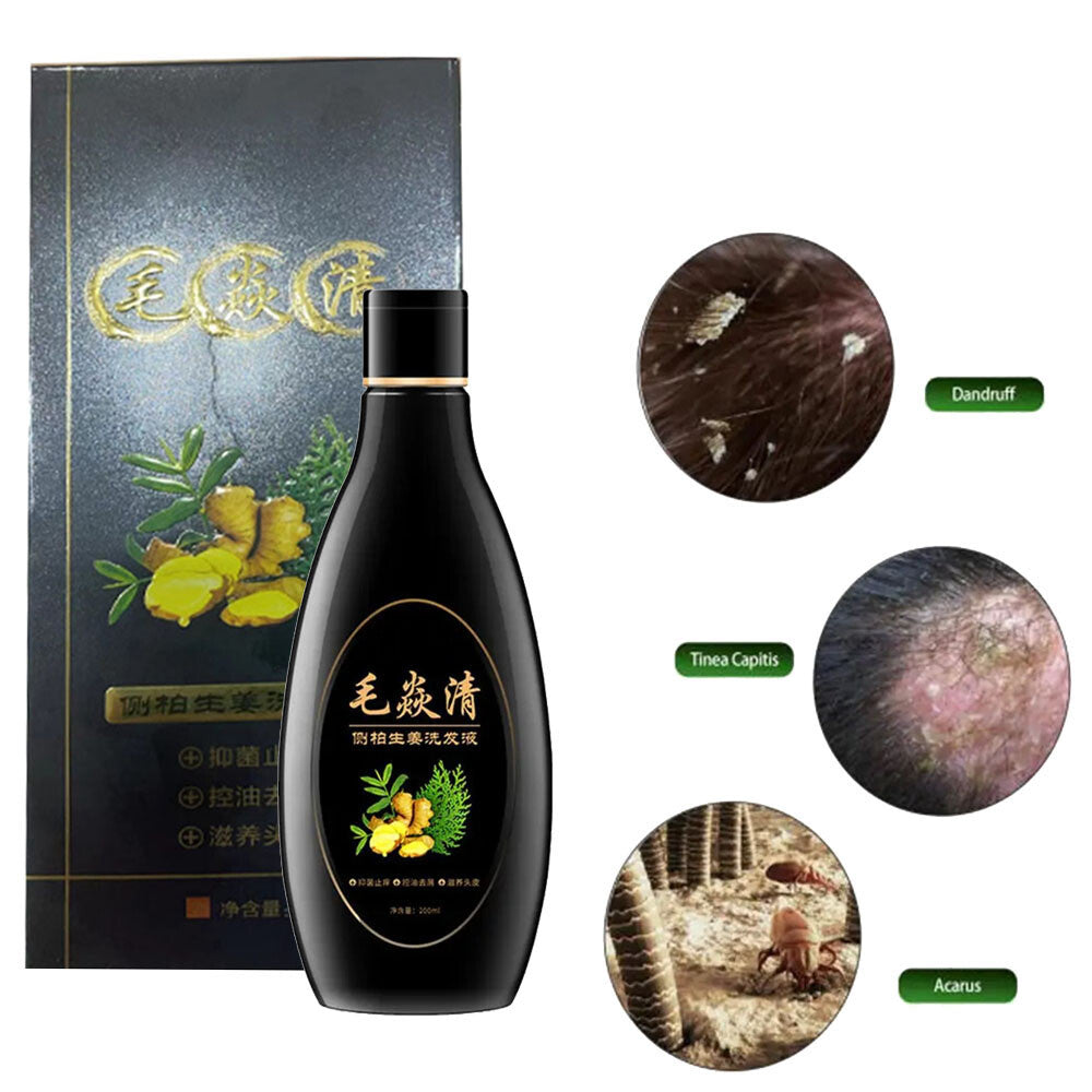 Natural Scalp & Hair Follicle Shampoo for Dandruff Itching Oil Control 200ml