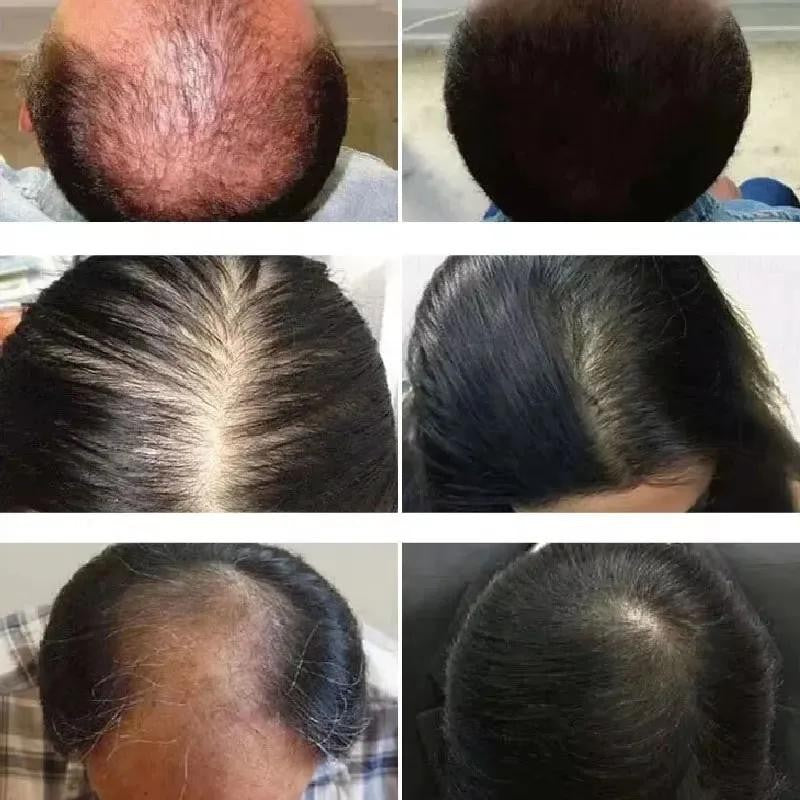 Hair Growth Oil for Hair Loss & Regrowth - Nourishing Rosemary Treatment 50ml