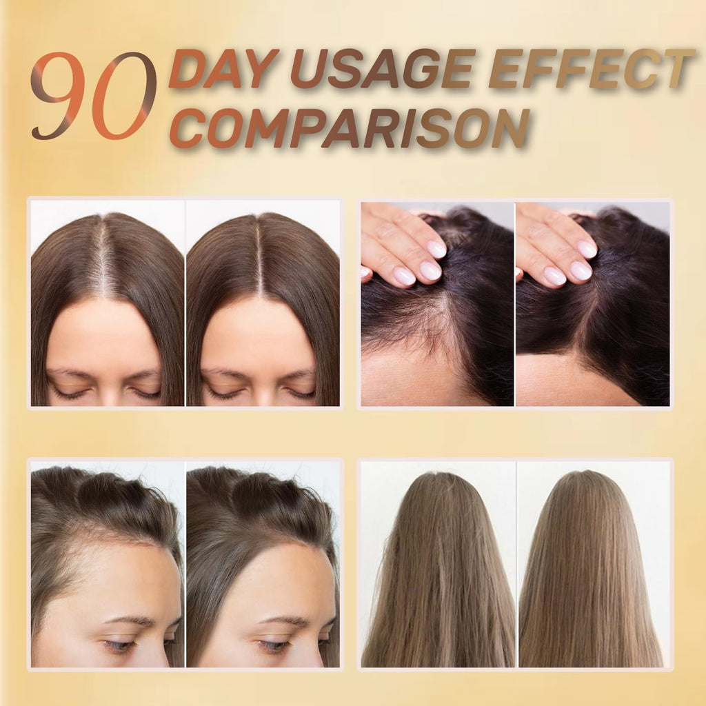 Botana Hair Growth Oil with for Nourishing Scalp & Stronger Hair - 4.23 Fl Oz