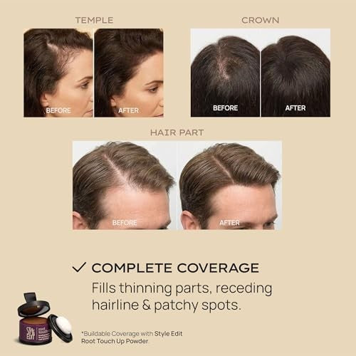 Hair Building Fibers Dark Brown 0.88oz - Instant Volume & Thickness for Thinning Hair