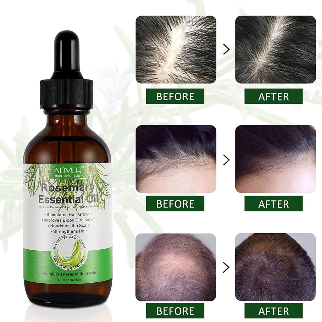 Organic Rosemary Hair Growth Oil - 2 Fl Oz Natural Hair Care Serum