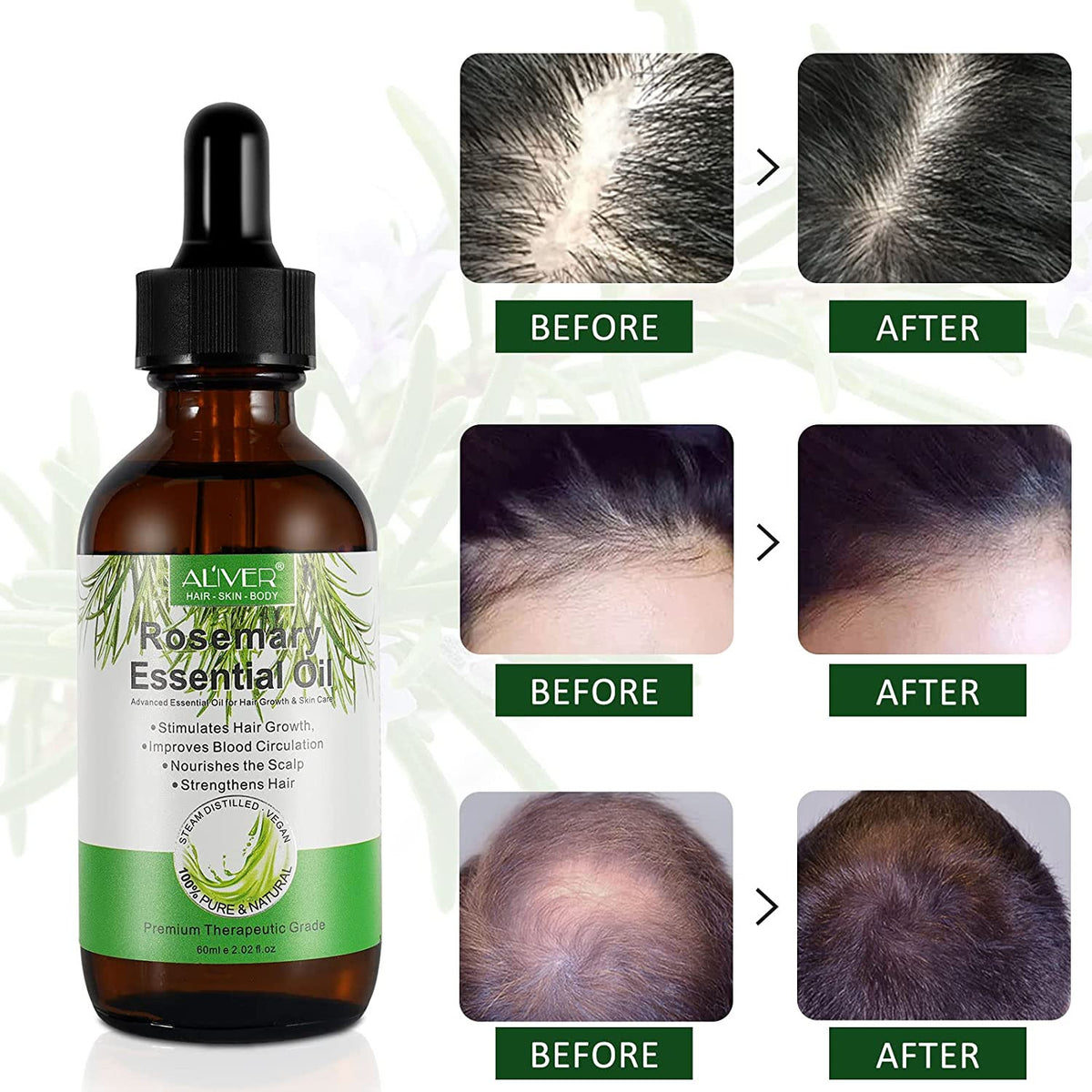 Organic Rosemary Hair Growth Oil - 2 Fl Oz Natural Hair Care Serum