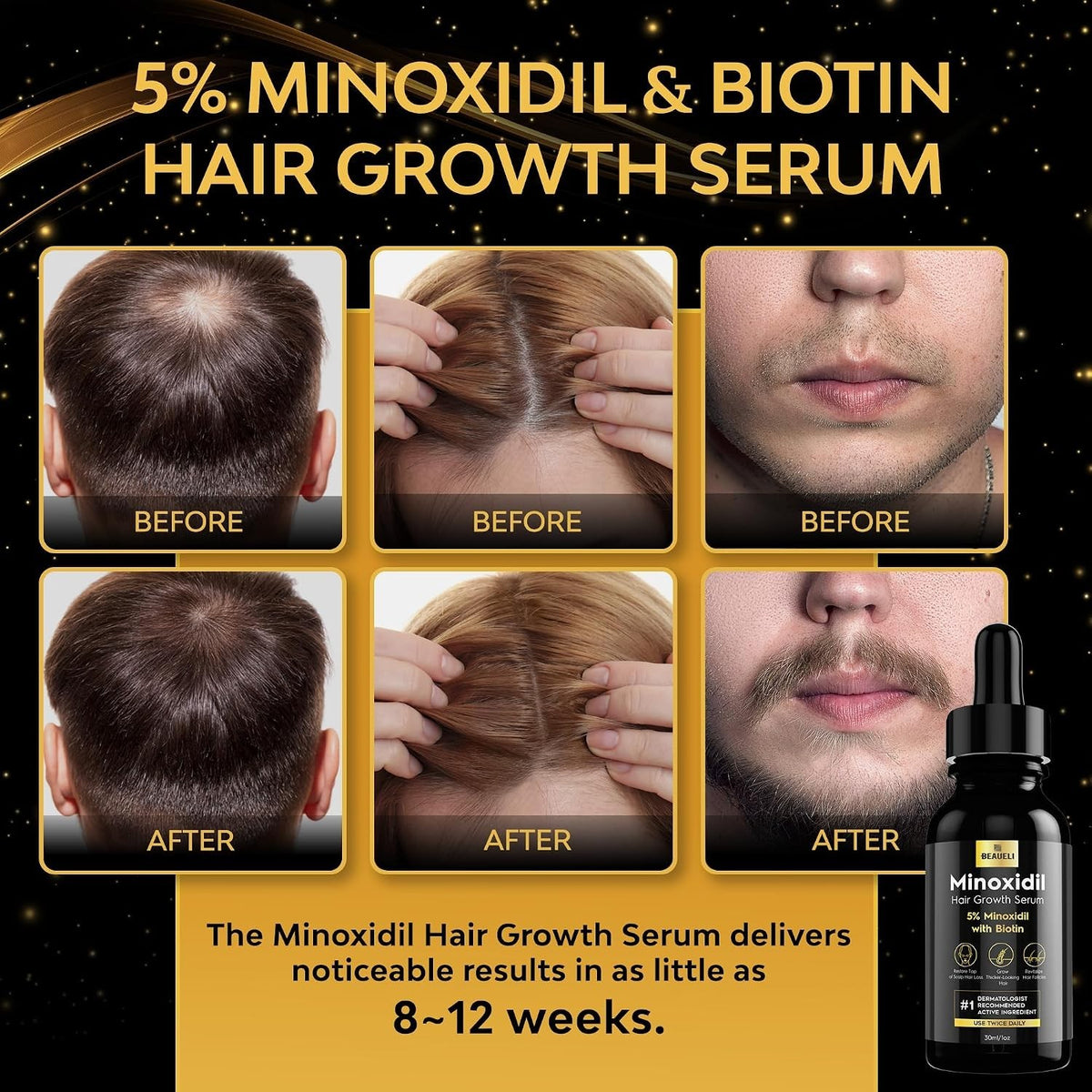 Minoxidil Hair & Beard Growth Serum - Unscented, 3 Bottles 3oz