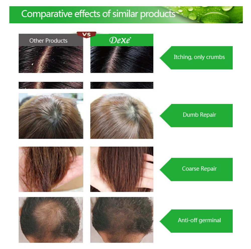 Anti Hair Loss Shampoo for Hair Growth - Natural Herbal Treatment, 200ml