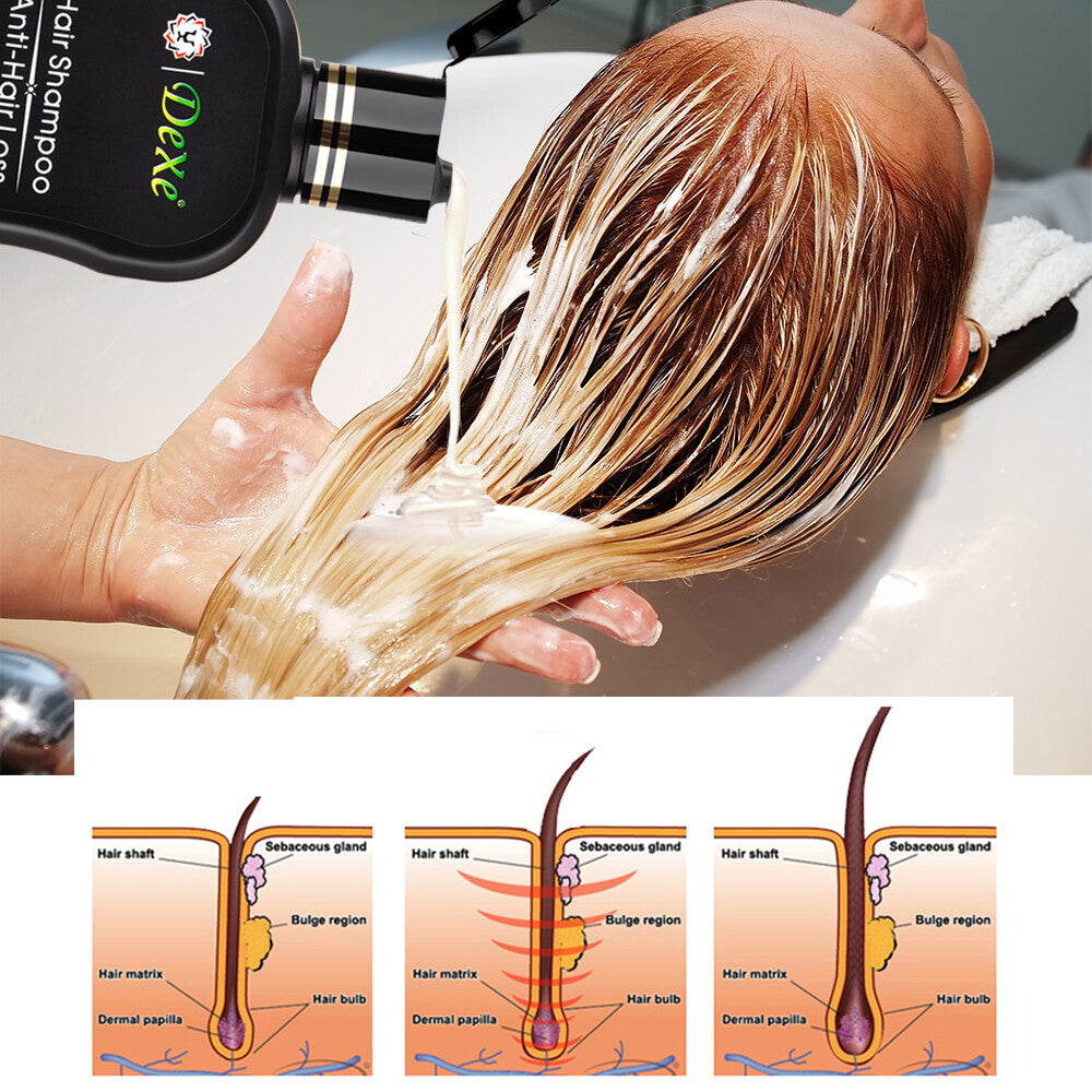 Anti-Hair Loss Shampoo for Men & Women - Herbal Hair Regrowth 200ml